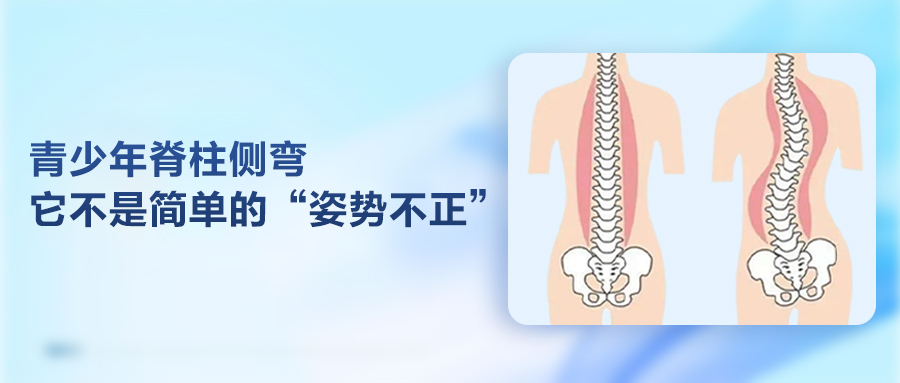 青少年脊柱侧弯，它不是简单的“姿势不正”！